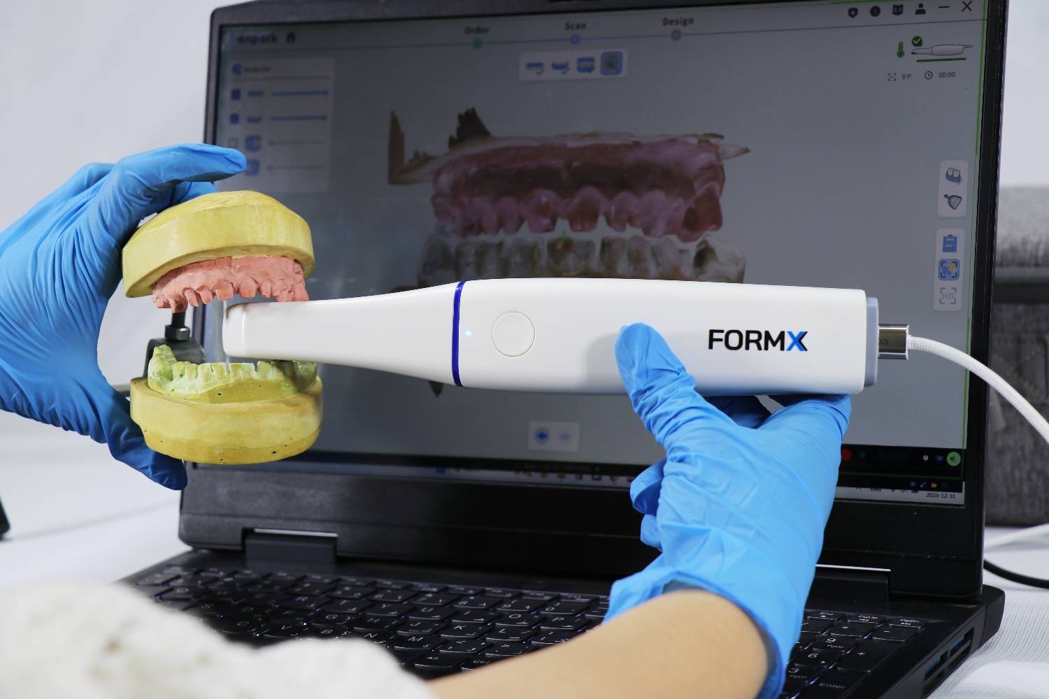 اسکنر داخل دهانی فرمیکس