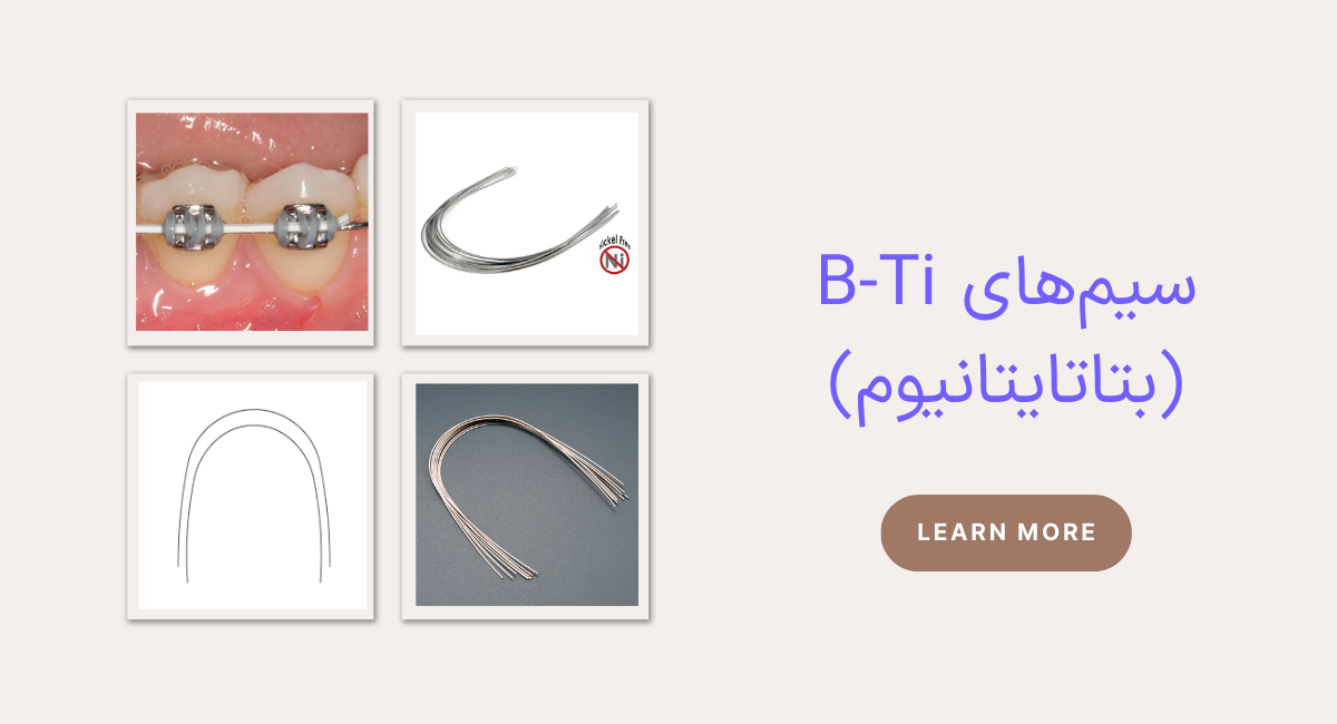 سیم‌های B-Ti (بتاتایتانیوم)